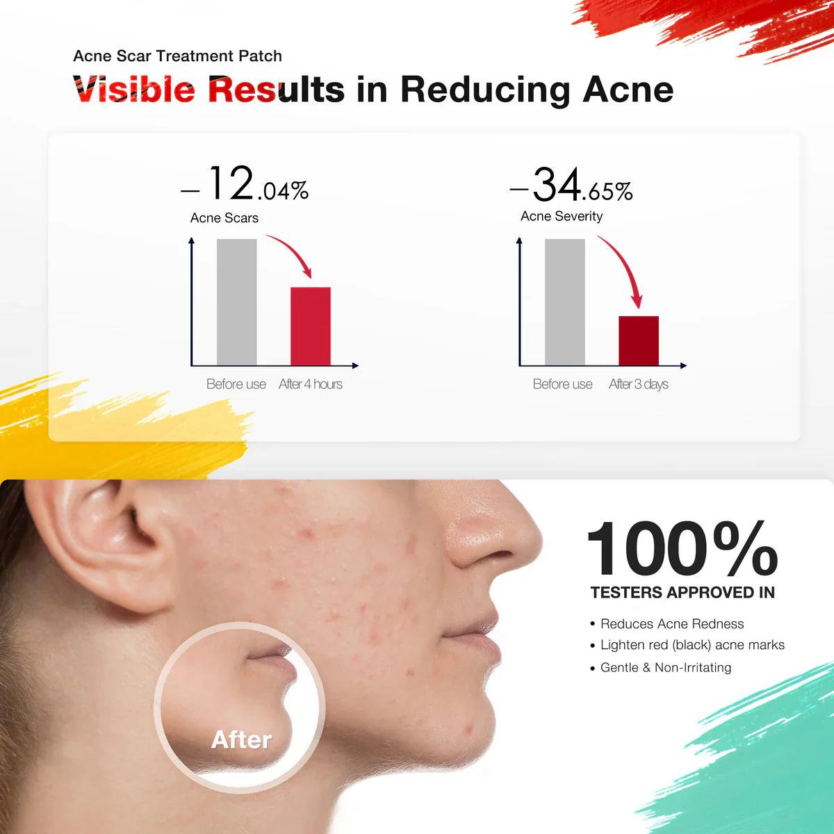 Acnebye Electronic Acne Patches 6pcs