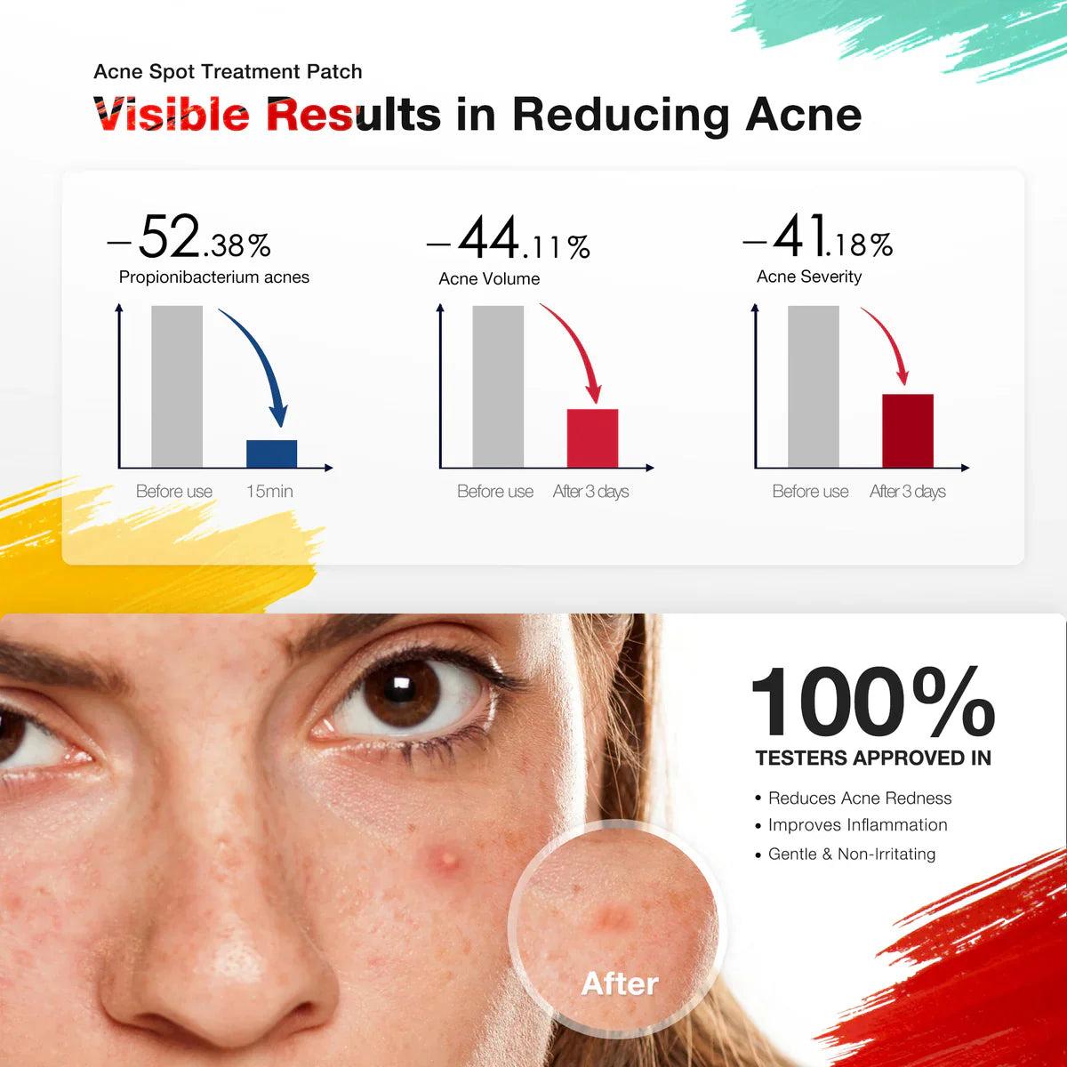 Acnebye Electronic Acne Patches 6pcs